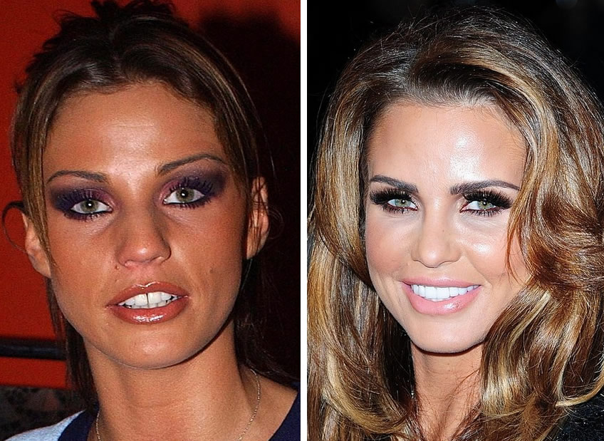 Katie Price