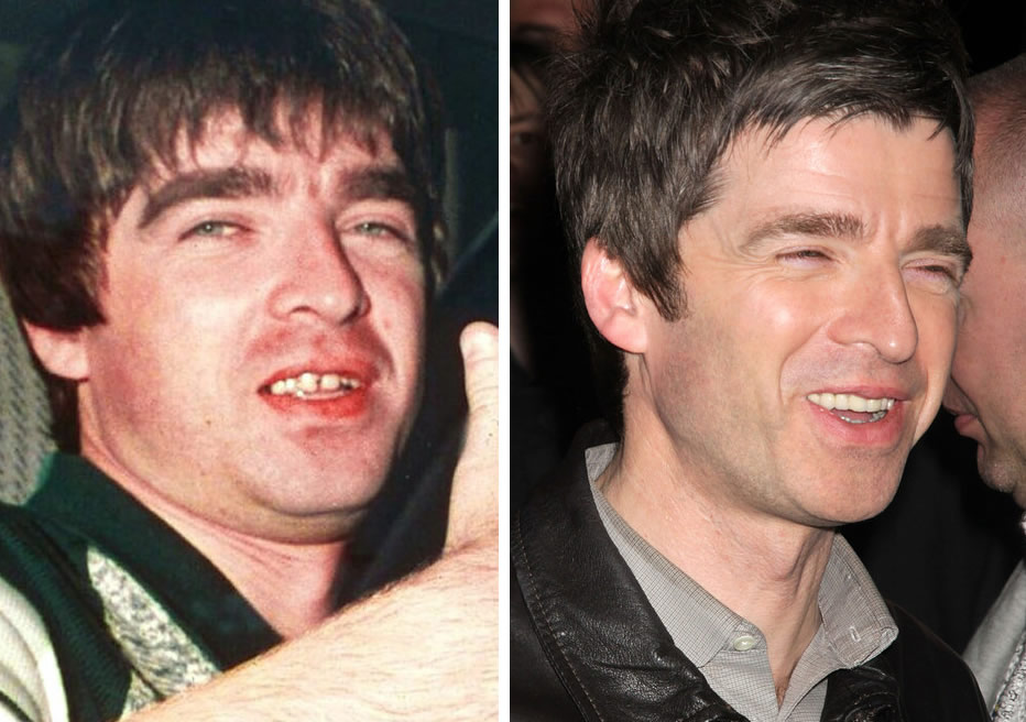 Noel Gallagher