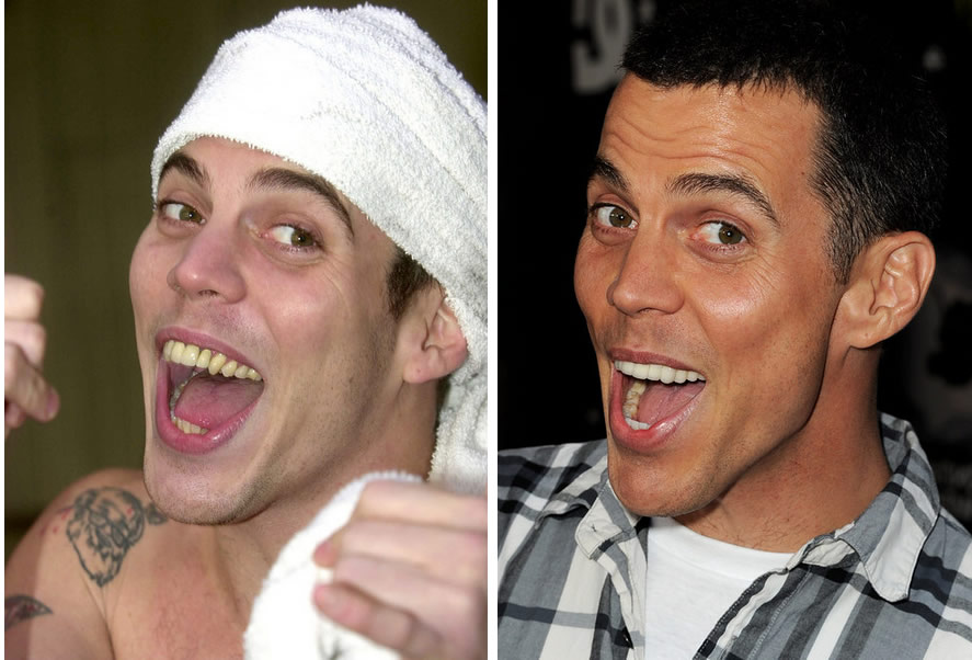 Steve-O