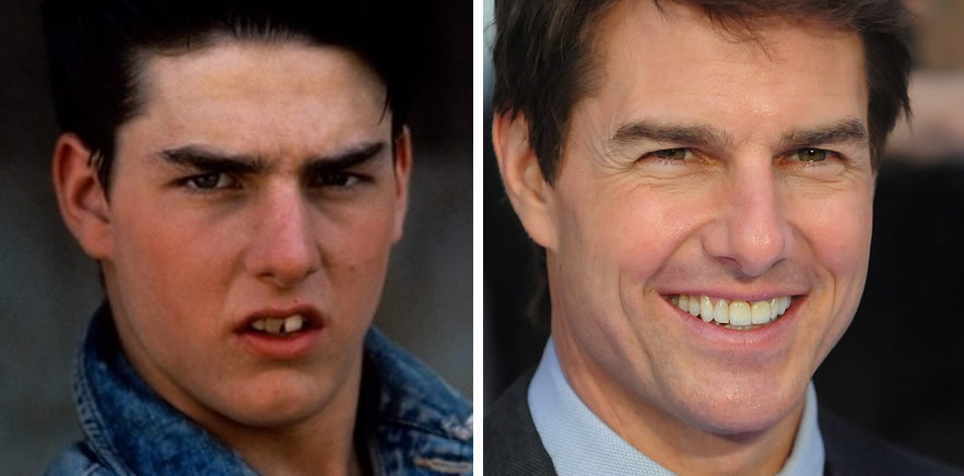 Tom Cruise