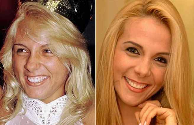 Antes-e-depois-artistas-brasileiros-15