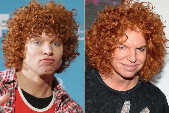 Carrot-Top