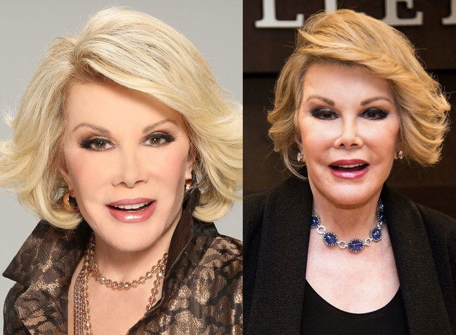 Joan-Rivers