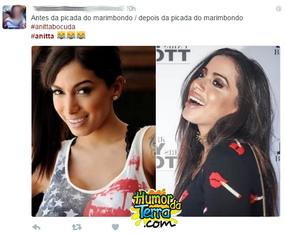 anitta-botox-humordaterra-1