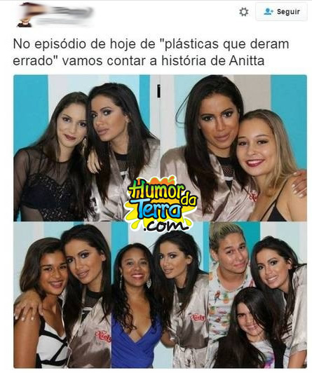 anitta-botox-humordaterra-3