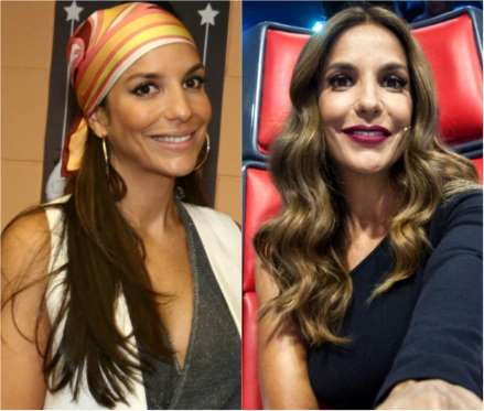 Ivete