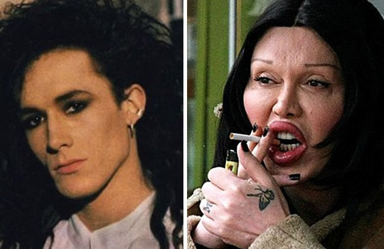 Pete Burns