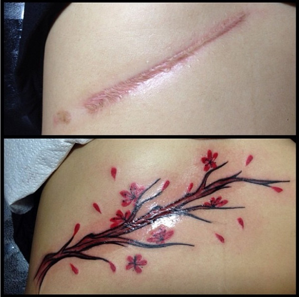 tatuagens-cicatrizes-1