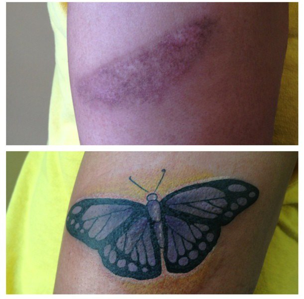 tatuagens-cicatrizes-13