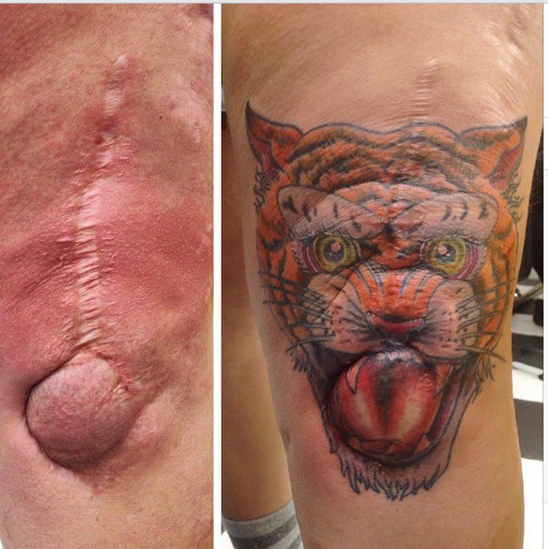 tatuagens-cicatrizes-16