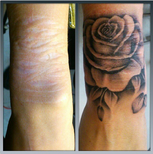 tatuagens-cicatrizes-18