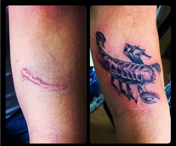 tatuagens-cicatrizes-19
