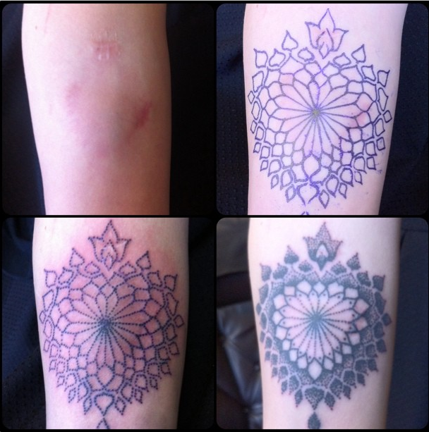 tatuagens-cicatrizes-3