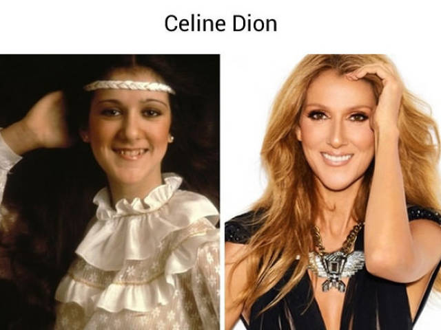 celebridades antes e depois da fama 18