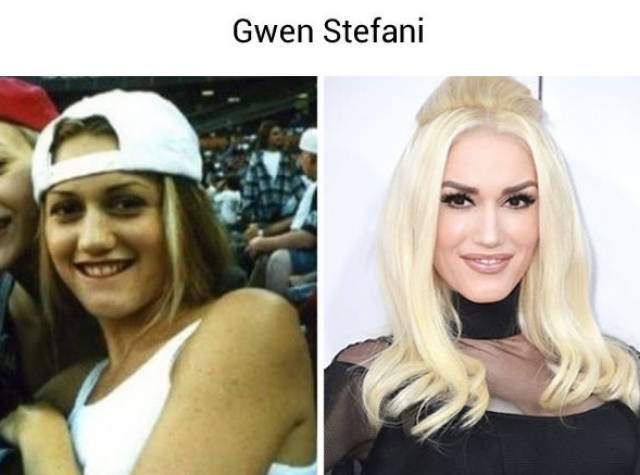 celebridades antes e depois da fama 20