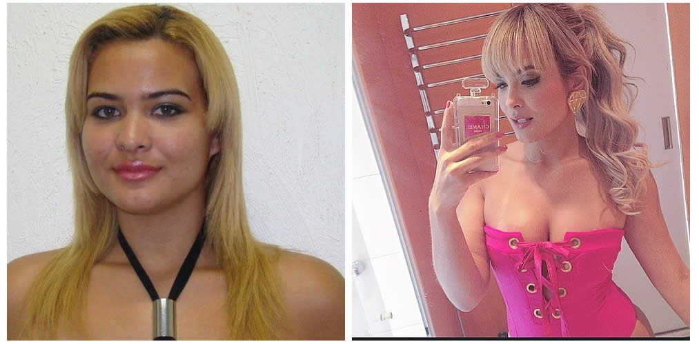 antes e depois da fama 1
