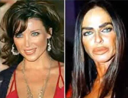 celebridades-plasticas-fails-7