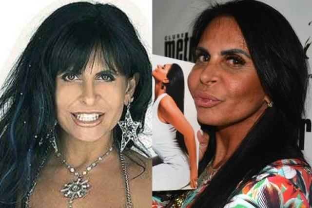 celebridades-plasticas-fails-face